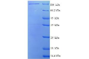 Image no. 1 for Discs, Large Homolog 3 (DLG3) (AA 1-849), (full length) protein (GST tag) (ABIN5711397)