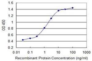 anti-Calcium Binding Protein 4 (CABP4) (AA 1-170) antibody