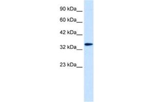 Image no. 1 for anti-Distal-Less Homeobox 6 (DLX6) antibody (ABIN2461204)