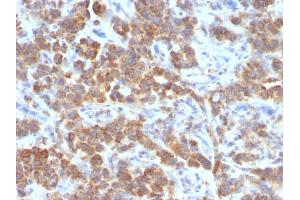 Image no. 3 for anti-Tumor Necrosis Factor (Ligand) Superfamily, Member 15 (TNFSF15) antibody (ABIN6941289)