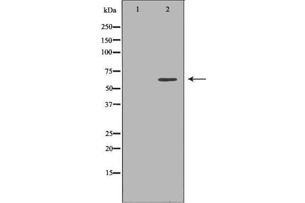 anti-Matrix Metallopeptidase 25 (MMP25) (Internal Region) antibody