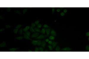 Cathepsin E anticorps