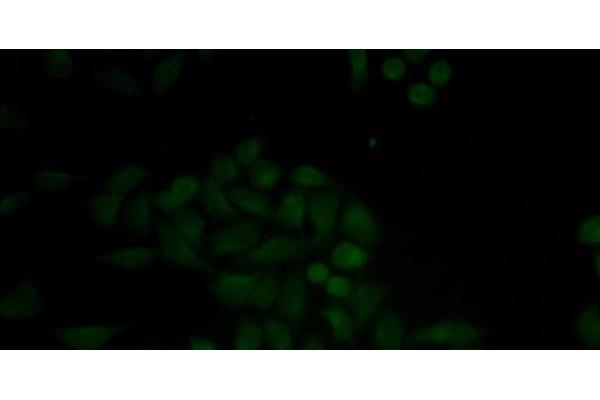 Cathepsin E anticorps