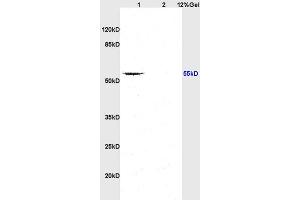 SDS-PAGE (SDS) image for anti-TGF beta Receptor 1 (AA 301-400) antibody (ABIN671256)