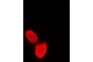 Image no. 1 for anti-SATB Homeobox 1 (SATB1) antibody (ABIN2967007)