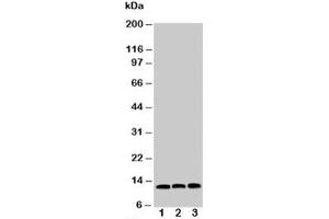 Image no. 2 for anti-Macrophage Migration Inhibitory Factor (Glycosylation-Inhibiting Factor) (MIF) (C-Term) antibody (ABIN3031673)