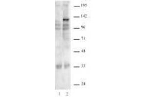 Western Blotting (WB) image for anti-CRISPR-Cas9 (AA 1-462) antibody (ABIN6731015)