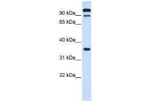 Image no. 1 for anti-Protein tyrosine Phosphatase, Receptor Type, E (PTPRE) (Middle Region) antibody (ABIN635886)