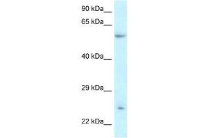 Image no. 2 for anti-Der1-Like Domain Family, Member 3 (DERL3) (Middle Region) antibody (ABIN2781868)
