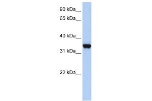 Image no. 4 for anti-Lactate Dehydrogenase A (LDHA) (Middle Region) antibody (ABIN2785876)