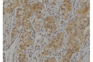Image no. 1 for anti-Solute Carrier Family 16, Member 1 (Monocarboxylic Acid Transporter 1) (SLC16A1) (pSer213) antibody (ABIN6269505)