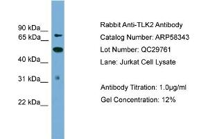 Image no. 2 for anti-Tousled-Like Kinase 2 (TLK2) (N-Term) antibody (ABIN2774221)
