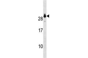 Image no. 1 for anti-Glutathione S-Transferase theta 2 (GSTT2) (AA 113-141) antibody (ABIN3031086)