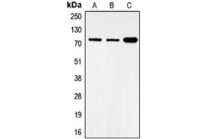 Image no. 1 for anti-Forkhead Box O1 (FOXO1) (pSer319) antibody (ABIN2706172)