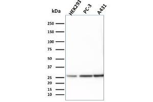 Image no. 1 for anti-14-3-3 epsilon (YWHAE) antibody (ABIN6940908)