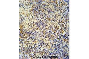 anti-KRI1 Homolog (KRI1) (N-Term) antibody