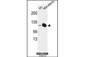 Western Blotting (WB) image for anti-Diaphanous Homolog 2 (DIAPH2) antibody (ABIN2158549)