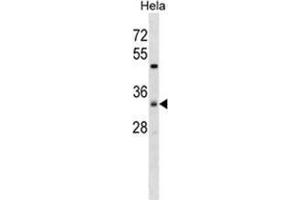 Image no. 1 for anti-Zinc Finger, DHHC-Type Containing 7 (ZDHHC7) (AA 239-267), (C-Term) antibody (ABIN955654)