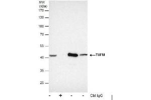 Image no. 2 for anti-Tu Translation Elongation Factor, Mitochondrial (Tufm) (Center) antibody (ABIN2855160)