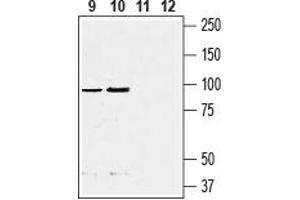 Western blot analysis of rat (lanes 9 and 11)  and mouse (lanes 10 and 12)  fat tissue lysate: - 9, 10.
