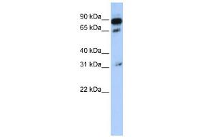 Image no. 1 for anti-ATP-Binding Cassette, Sub-Family D (Ald), Member 4 (ABCD4) (N-Term) antibody (ABIN2781508)