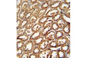 Image no. 2 for anti-Degenerative Spermatocyte Homolog 2, Lipid Desaturase (DEGS2) (AA 268-298), (C-Term) antibody (ABIN951878)