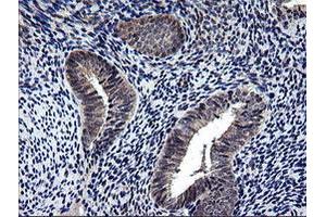 Image no. 5 for anti-NIMA (Never In Mitosis Gene A)-Related Kinase 11 (NEK11) antibody (ABIN1499682)