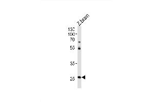 Image no. 1 for anti-Homeobox C4 (HOXC4) (AA 240-267), (C-Term) antibody (ABIN1881432)