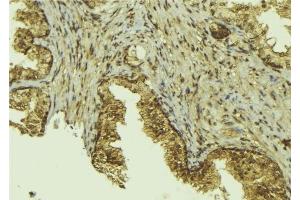 Image no. 2 for anti-CCCTC-Binding Factor (Zinc Finger Protein) (CTCF) (C-Term) antibody (ABIN6261079)
