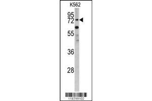 Image no. 1 for anti-Zinc Finger and BTB Domain Containing 16 (ZBTB16) (AA 637-666), (C-Term) antibody (ABIN390611)