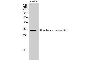 Image no. 1 for anti-Olfactory Receptor, Family 9, Subfamily Q, Member 1 (OR9Q1) (C-Term) antibody (ABIN3186208)