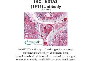 Image no. 1 for anti-Glutathione S-Transferase alpha 3 (GSTA3) (AA 1-223), (full length) antibody (ABIN1723472)