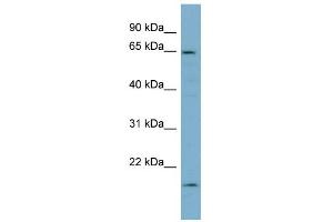 Image no. 1 for anti-Plastin 3 (PLS3) (Middle Region) antibody (ABIN2786800)