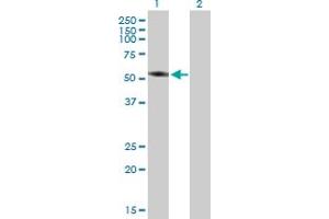 Image no. 1 for anti-TBC1 Domain Family, Member 2 (TBC1D2) (AA 1-502) antibody (ABIN527519)