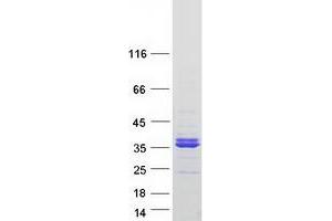 Image no. 1 for phospholipid Scramblase 3 (PLSCR3) protein (Myc-DYKDDDDK Tag) (ABIN2729195)