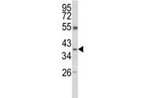 Image no. 3 for anti-Arginase, Liver (ARG1) (AA 293-322) antibody (ABIN3030017)
