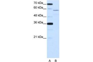 Image no. 1 for anti-Neuro-Oncological Ventral Antigen 2 (NOVA2) antibody (ABIN2462125)