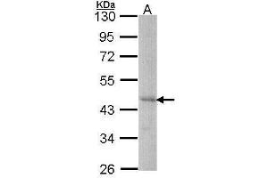 Image no. 1 for anti-Dyslexia Susceptibility 1 Candidate 1 (DYX1C1) (C-Term) antibody (ABIN2856307)