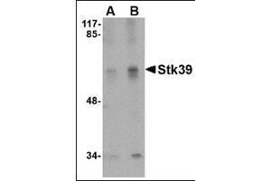 Image no. 2 for anti-serine threonine Kinase 39 (STK39) (C-Term) antibody (ABIN500833)