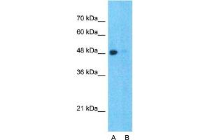 Image no. 3 for anti-Speckle-Type POZ Protein (SPOP-B) (C-Term) antibody (ABIN2784150)