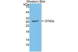 Image no. 1 for anti-GATA Binding Protein 2 (GATA2) (AA 117-338) antibody (ABIN1980407)