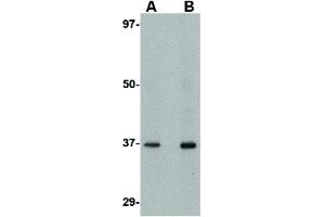 Image no. 2 for anti-Aryl Hydrocarbon Receptor Interacting Protein-Like 1 (AIPL1) (C-Term) antibody (ABIN6655834)
