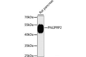 Western blot analysis of extracts of Rat pancreas using PNLIPRP2 Polyclonal Antibody at dilution of 1:3000.