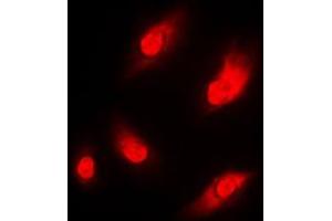 Image no. 1 for anti-N(alpha)-Acetyltransferase 15, NatA Auxiliary Subunit (NAA15) (Center) antibody (ABIN2706637)