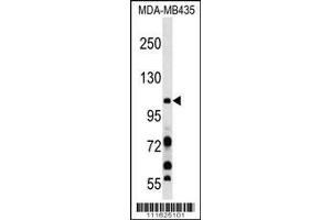 Image no. 2 for anti-Phosphoinositide-3-Kinase, Catalytic, beta Polypeptide (PIK3CB) (AA 124-154), (N-Term) antibody (ABIN652426)