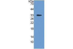 Image no. 3 for Lipopolysaccharide Binding Protein (LBP) ELISA Kit (ABIN6574276)