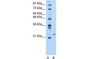 Image no. 1 for anti-Polyamine Modulated Factor 1 (PMF1) (Middle Region) antibody (ABIN2777754)