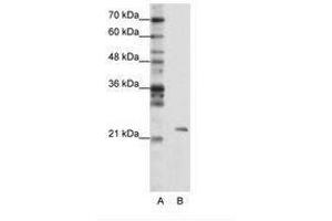Image no. 1 for anti-Mitochondrial rRNA Methyltransferase 1 Homolog (MRM1) (AA 25-74) antibody (ABIN203015)