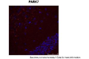 Image no. 3 for anti-Parkinson Protein 7 (PARK7) (C-Term) antibody (ABIN2784491)