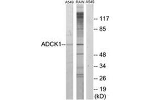 Image no. 1 for anti-AarF Domain Containing Kinase 1 (ADCK1) (AA 251-300) antibody (ABIN1533979)